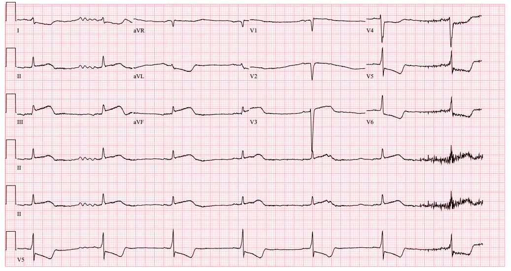 Example of time series: health monitoring records.